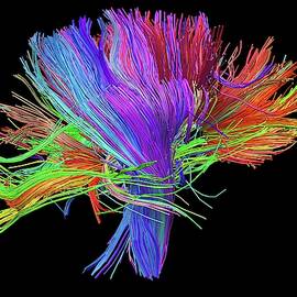 White Matter Fibres Of The Human Brain by Science Photo Library